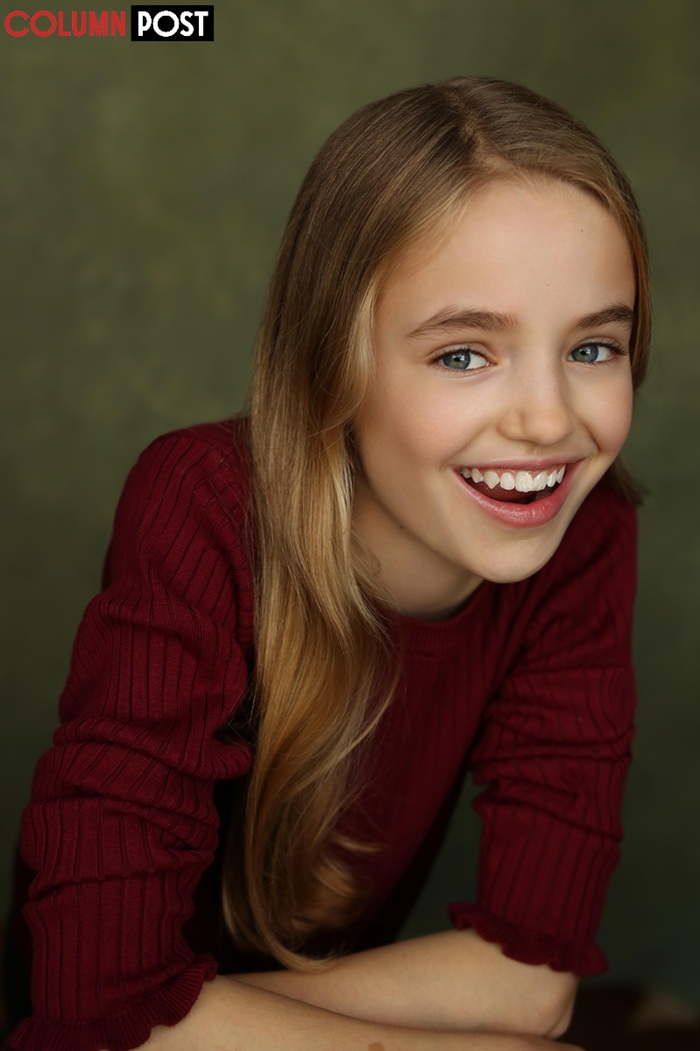 The Acting Itch